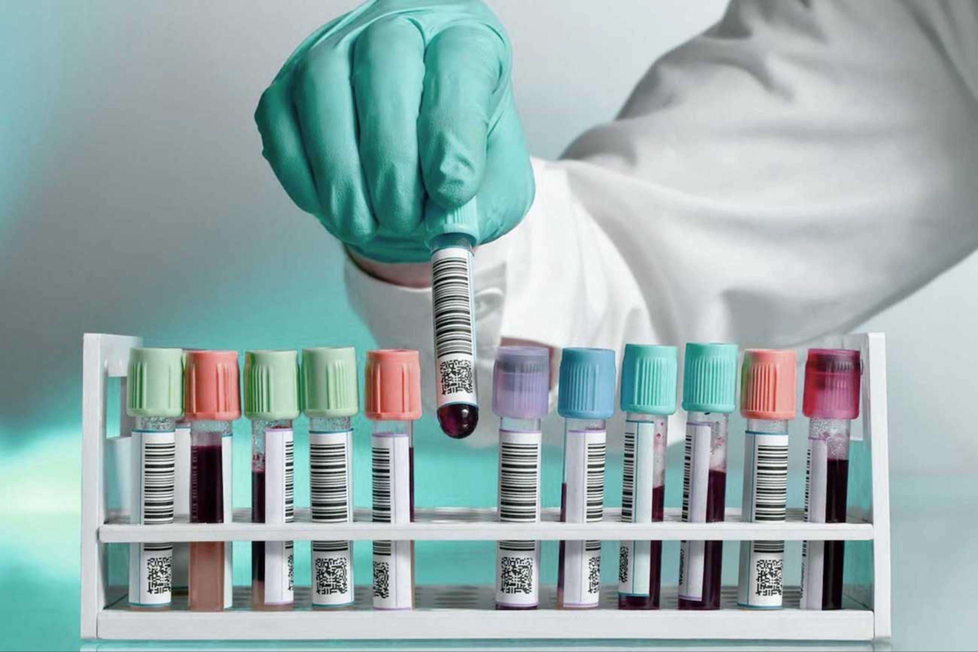 Blood test samples